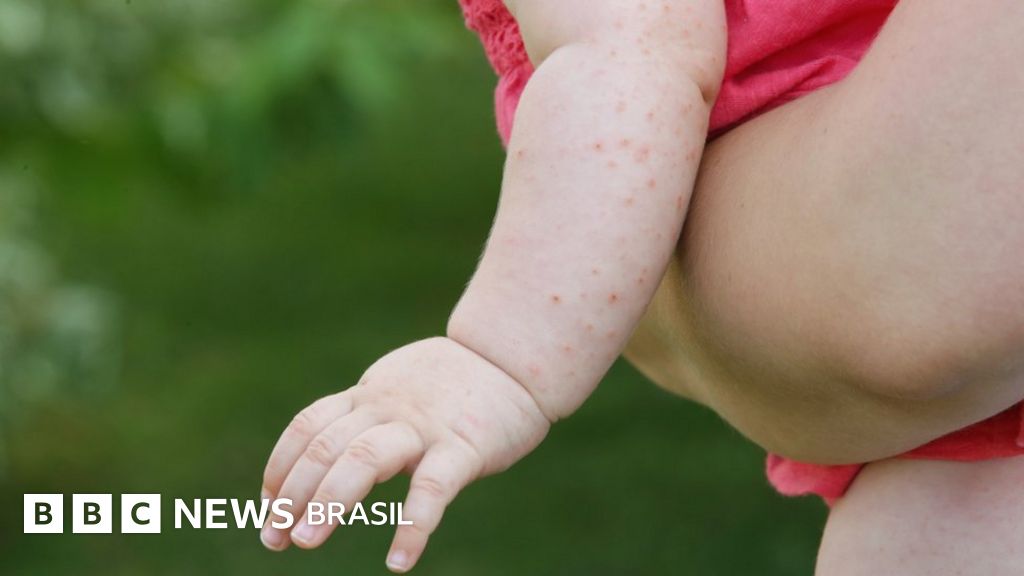 pintas vermelhas na pele de bebe
