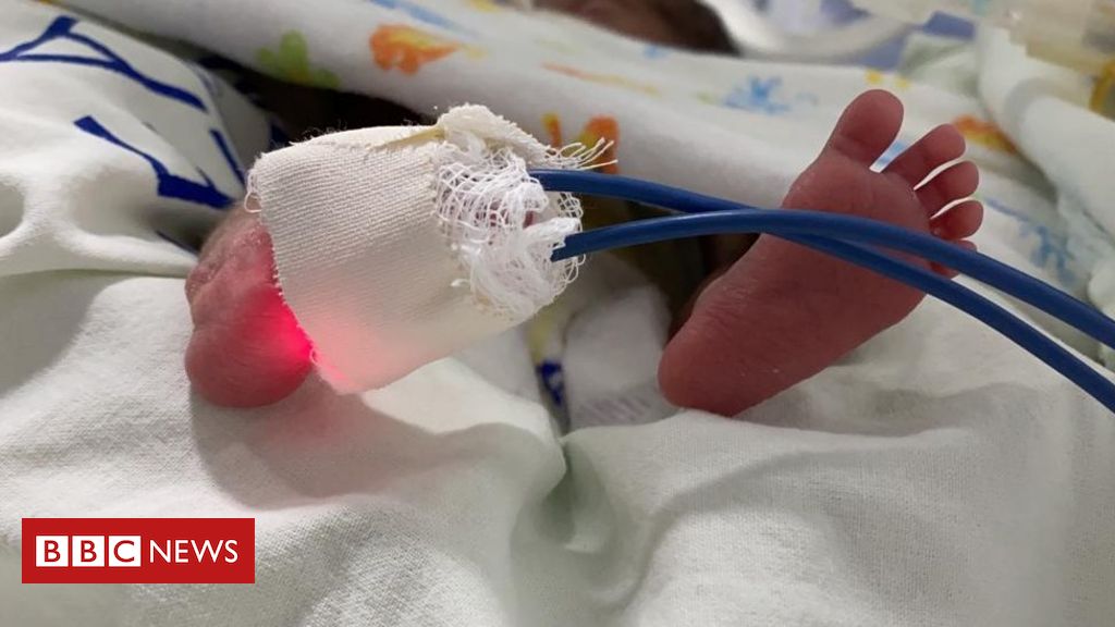 Coronavírus: infectado, Leandrinho perdeu o parto da filha e só abraçou  bebê após duas semanas - Esporte - Extra Online
