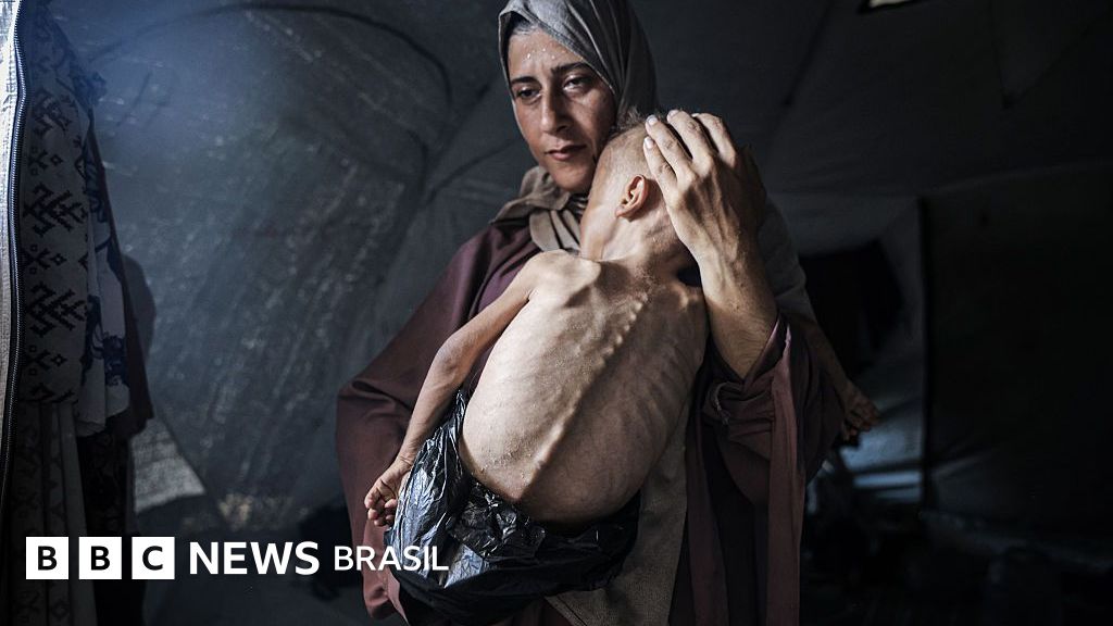 A história por trás da chocante foto do bebê faminto de Gaza
