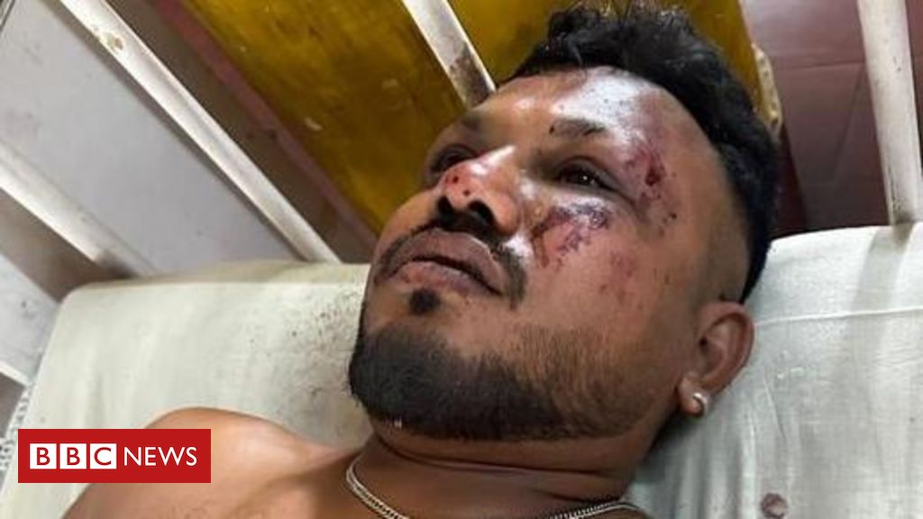 Como único sobrevivente de queda de avião na Índia conseguiu se salvar: 'Houve um barulho alto e, em seguida, o avião caiu'