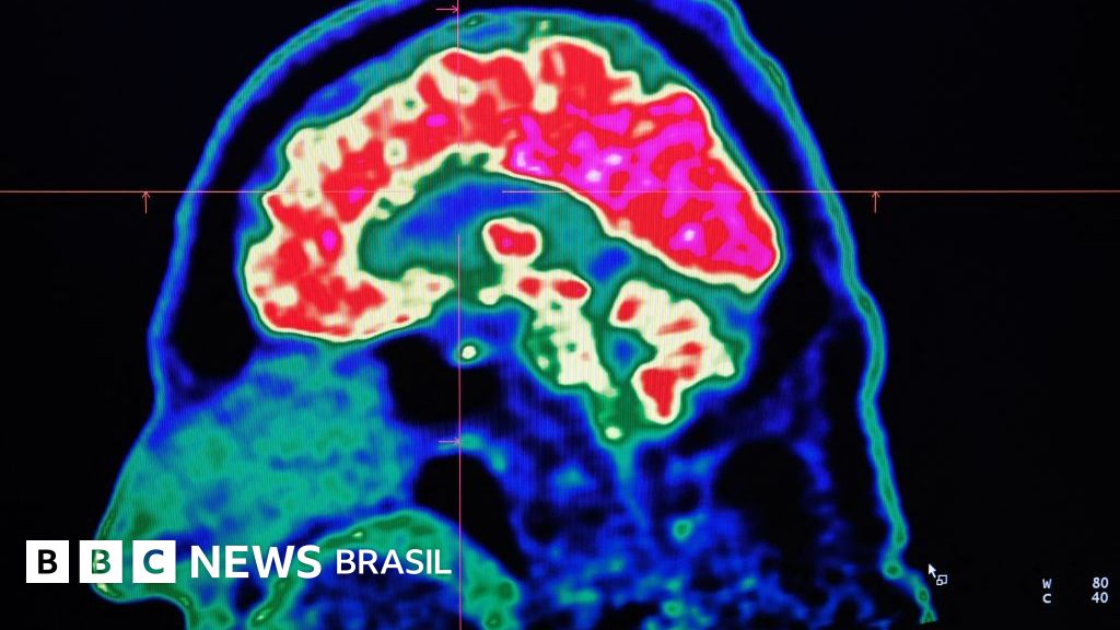 O mundo está ficando mais quente — e isso está afetando nossos cérebros