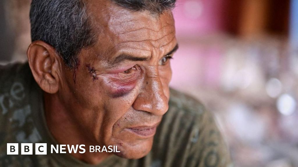 'Nunca pensei que fossem me atacar': os sobreviventes de ataque com míssil durante bombardeios dos EUA à Venezuela