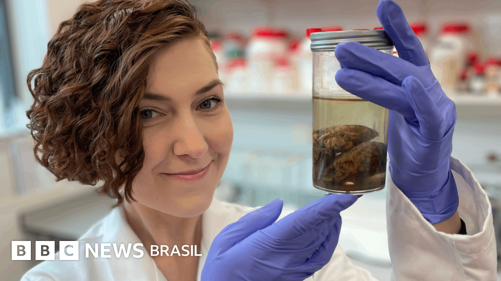 O mistério dos cérebros preservados por milênios de forma natural