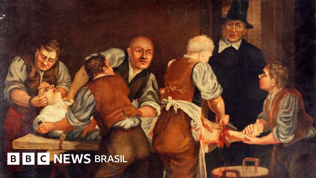 O gesto simples do cirurgião Joseph Lister que revolucionou a Medicina e inspirou o Listerine e a Johnson & Johnson