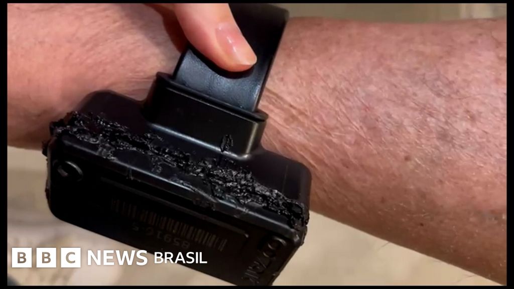 Bolsonaro diz que usou ferro de solda em tornozeleira: 'Curiosidade'