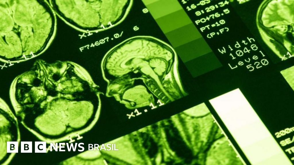 Os efeitos da solidão no cérebro de idosos