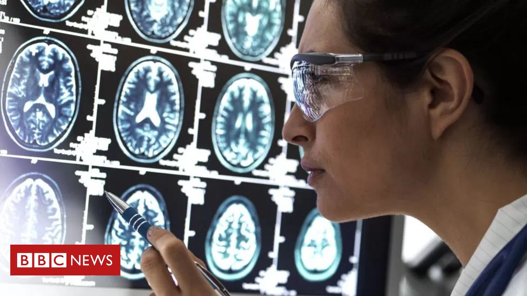 O novo remédio que 'interrompe' evolução do Alzheimer