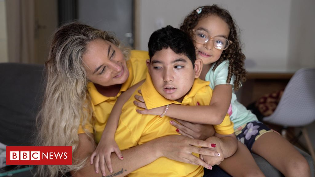 Como estão crianças com microcefalia, 10 anos após a epidemia de zika