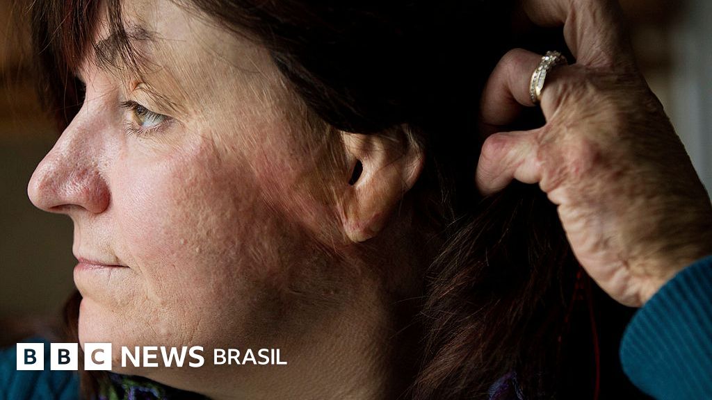 'Um incêndio mortal devastou a boate em apenas 90 segundos. Eu consegui sair'