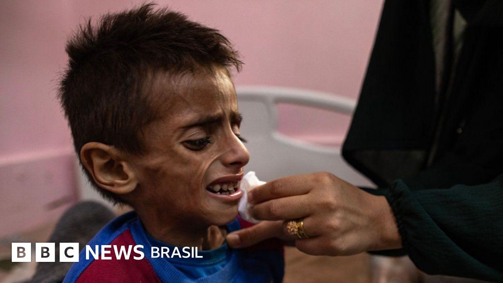 Gaza enfrenta 'pior cenário possível de fome', diz órgão de segurança alimentar ligado à ONU