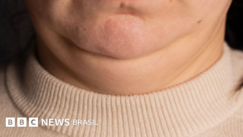 O que o tamanho do seu pescoço pode dizer sobre sua saúde?