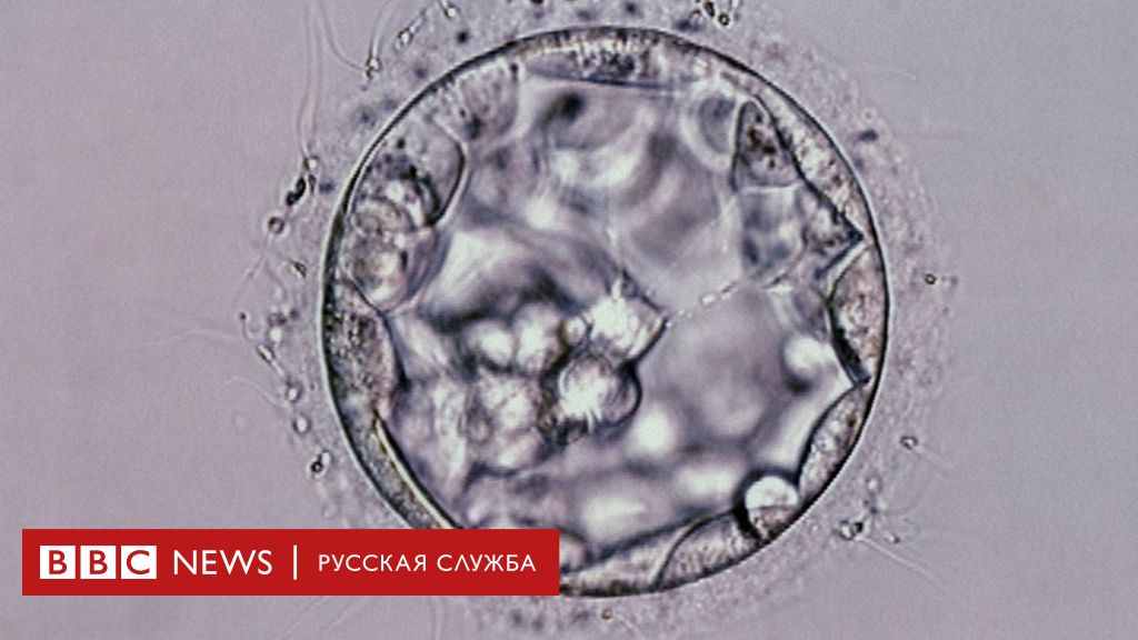 Эмбрион 5 дней фото под микроскопом