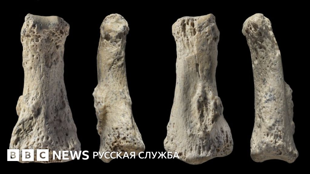 Возможность развития дегенеративных заболеваний сетчатки