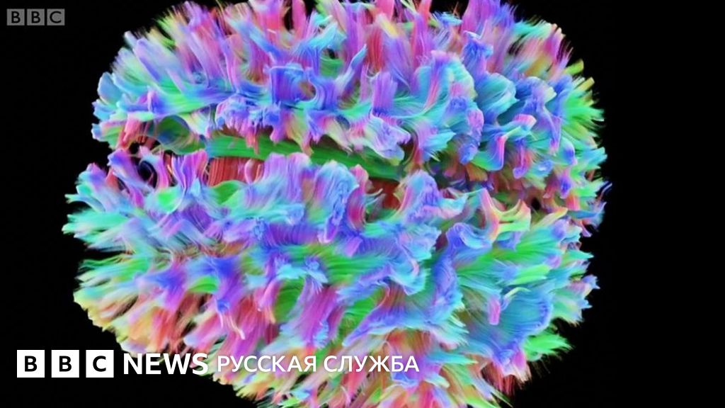 Какого цвета серое вещество: 3D-модель мозга человека - BBC News ...