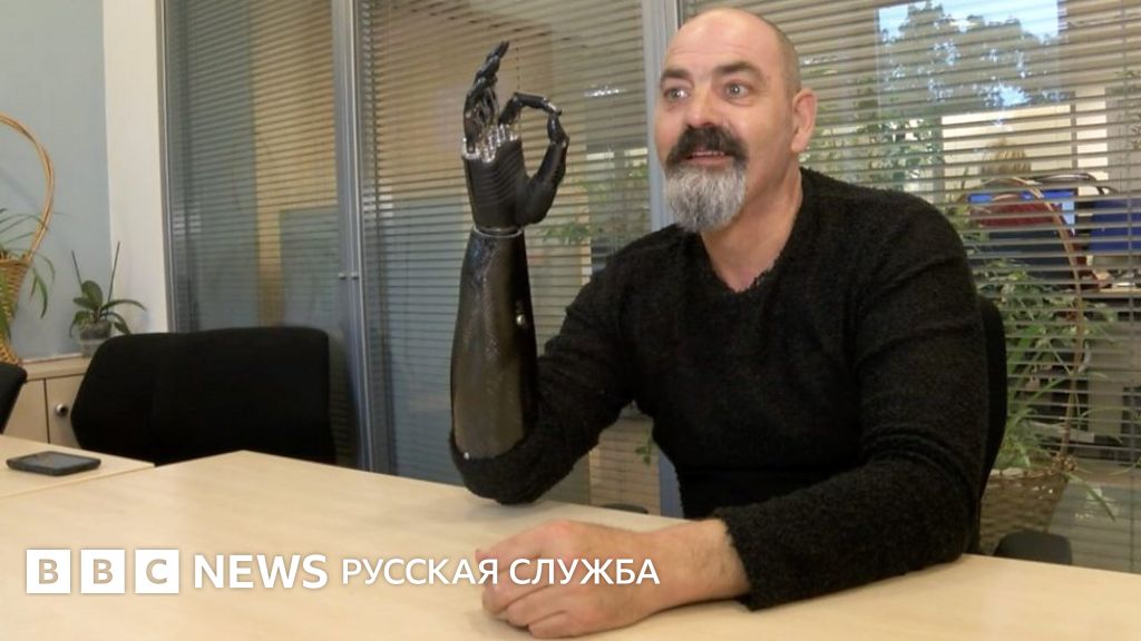 Бионическая рука: как технологии меняют жизнь - BBC News Русская служба