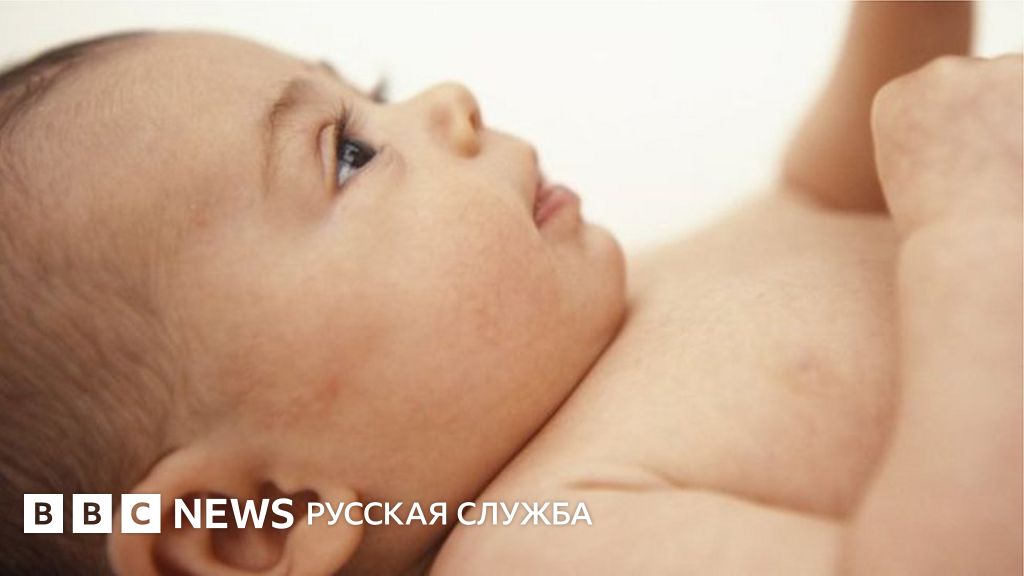 Британский регулятор одобрил рождение детей от трех родителей - BBC ...