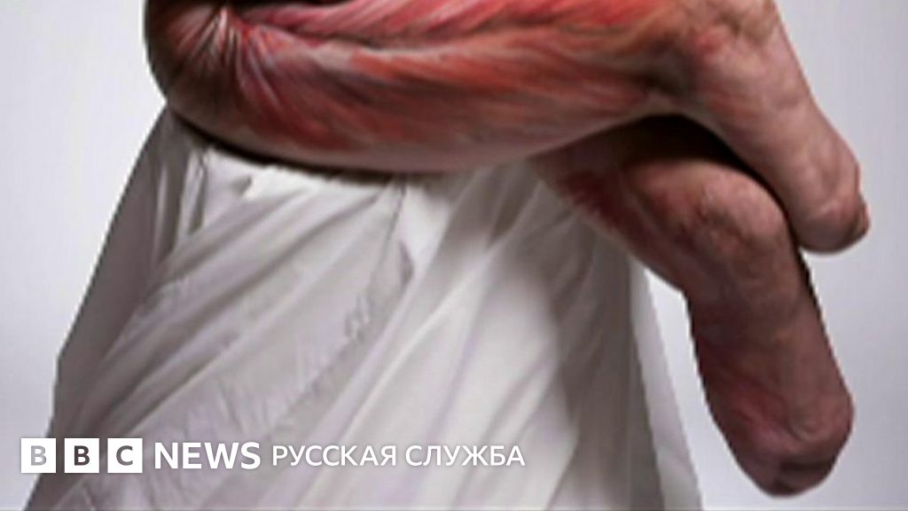 Британская женщина-инвалид разделась, чтобы найти новые руки - BBC News Русская служба