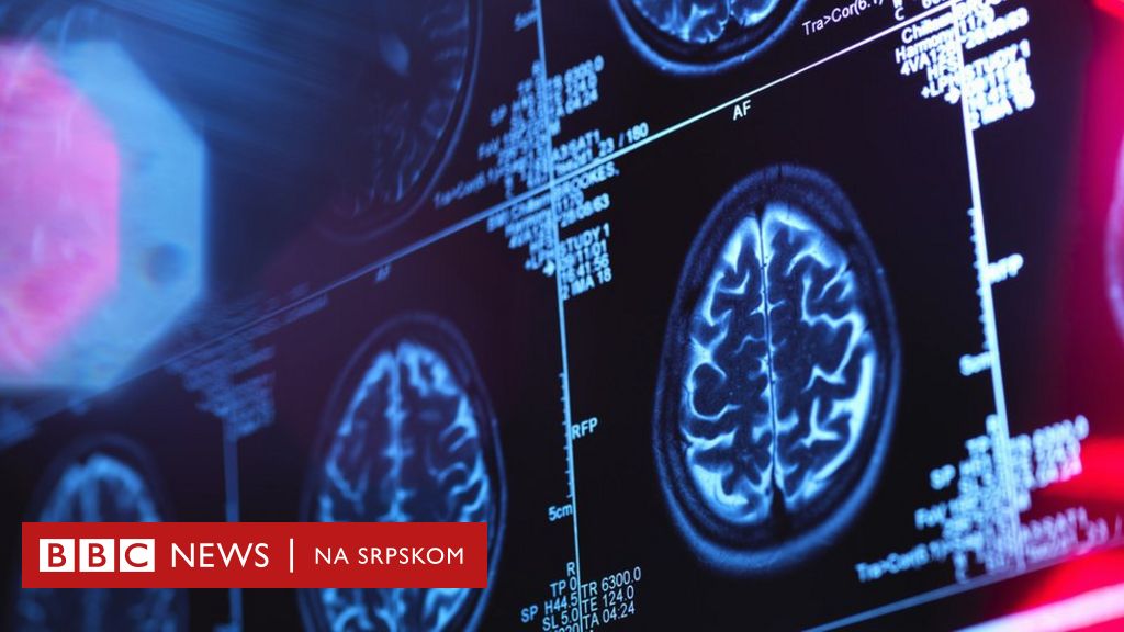 Scienza e salute mentale: l’intelligenza artificiale può aiutare a curare il morbo di Alzheimer