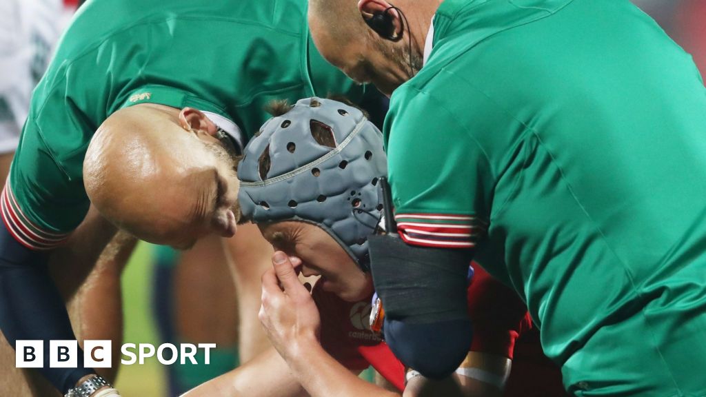 Rugby injuries: Eight-point plan to reduce risks includes review of laws