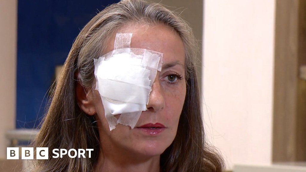 Ryder Cup: Spectator blinded in one eye says she could have died on golf course
