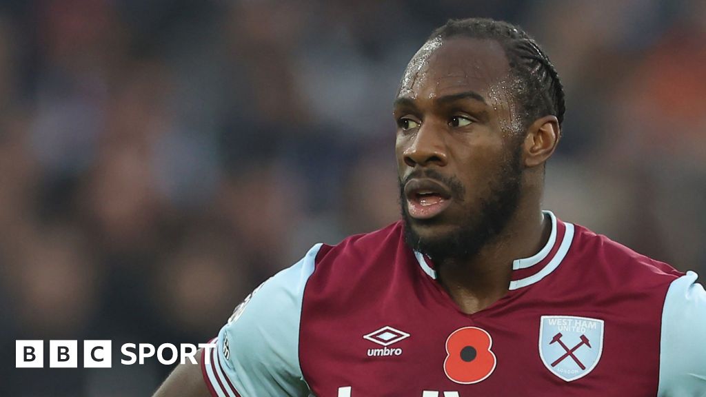 Antonio has surgery on lower limb fracture