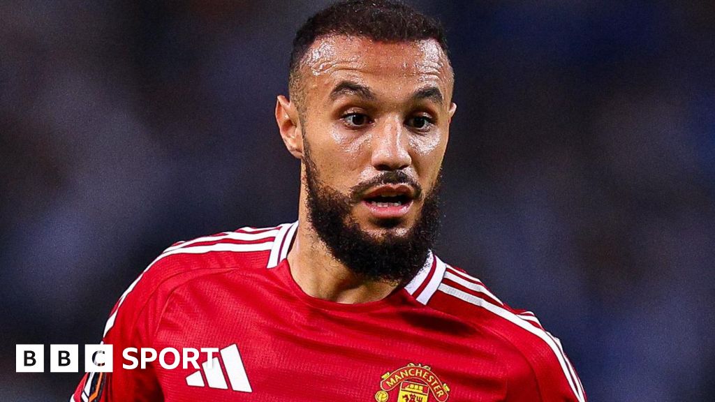 Noussair Mazraoui: Manchester United defender has minor procedure