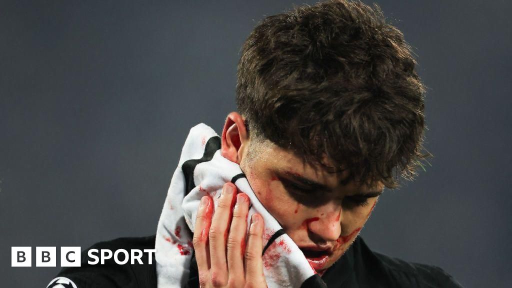 Barcelona defender Pau Cubarsi ‘fine’ after needing 10 stitches following kick to face