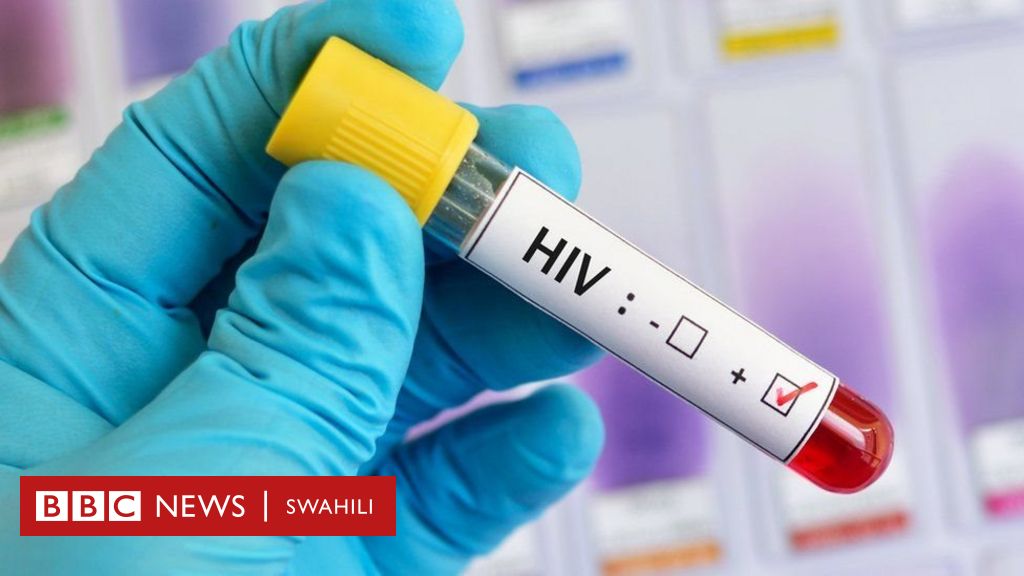 Wanasayansi Wabaini Watu Wanaoweza Kudhibiti Virusi Vya HIV Nchini DR Congo Bila Kutumia Dawa