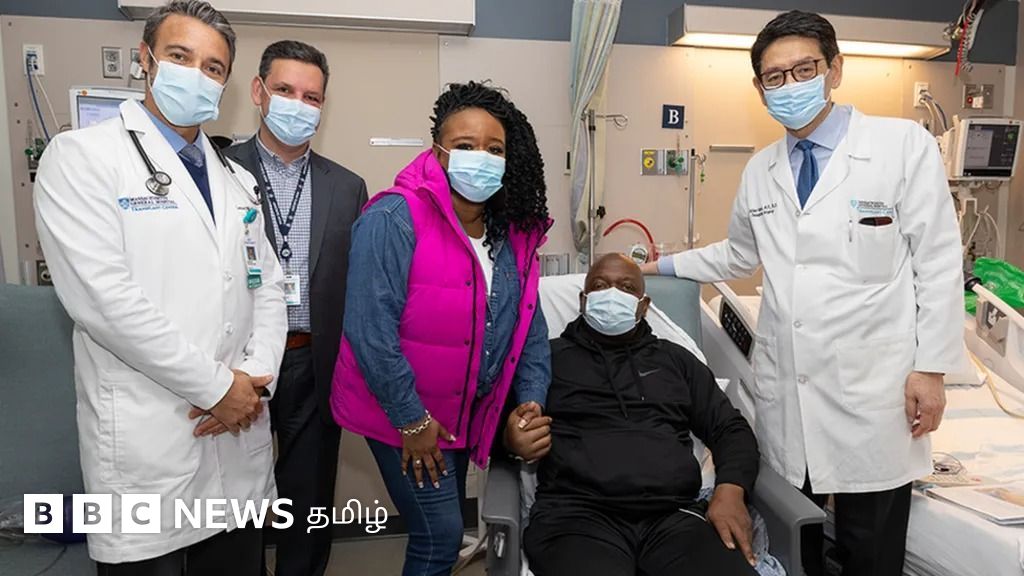 உடலில் பன்றி சிறுநீரகம் பொருத்தப்பட்ட முதல் நபர் - உறுப்பு மாற்று அறுவை சிகிச்சையில் புதிய மைல்கல்