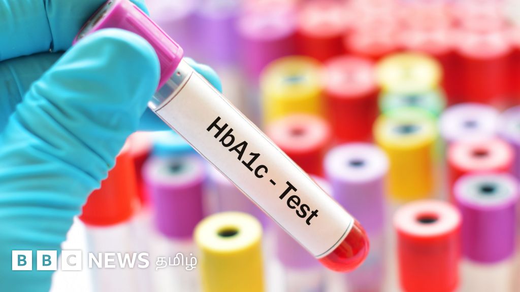 HbA1C: நீரிழிவு நோயாளிகள் மட்டும்தான் இந்த பரிசோதனையை செய்ய வேண்டுமா? முடிவுகள் உணர்த்துவது என்ன? 
