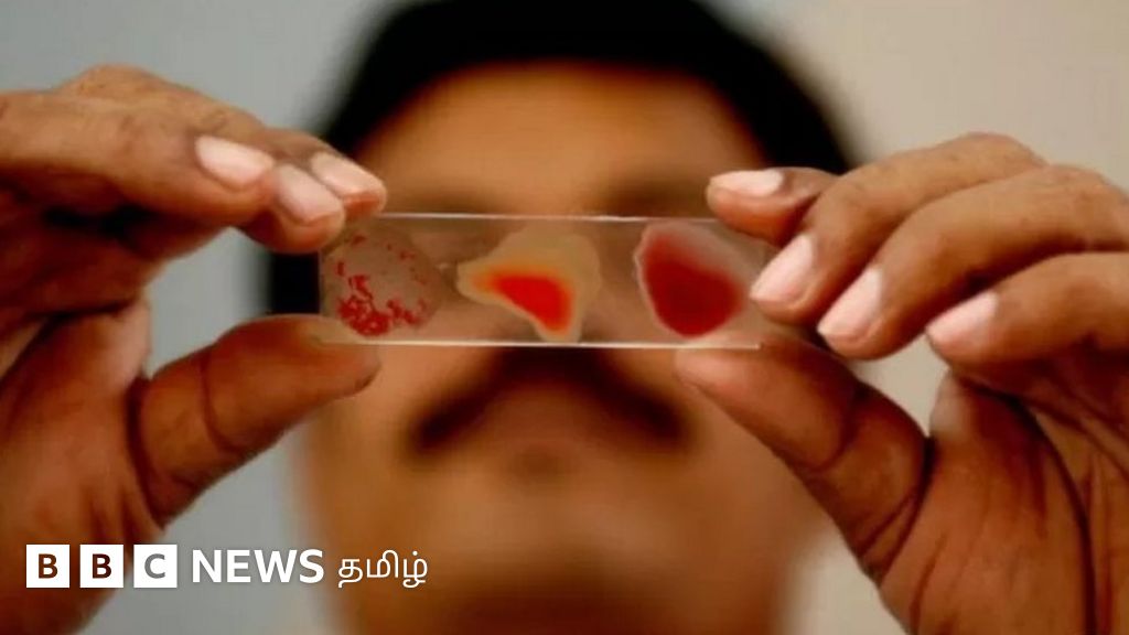 உலக ரத்த கொடையாளர் தினம்: 'பாம்பே ஓ' அவ்வளவு அரிதானதா? நெகிழ்ச்சிக் கதைகள்