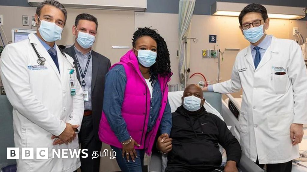 அமெரிக்காவில் பன்றியின் சிறுநீரகம் பொருத்தப்பட்ட நபர் 2 மாதங்களில் உயிரிழப்பு - என்ன காரணம்?