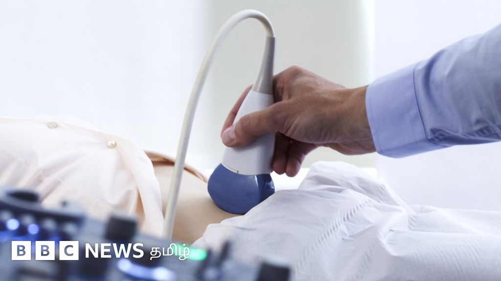 தருமபுரியில் நவீன ஸ்கேன் மூலம் பாலினத்தைக் கண்டறிந்து கருக்கலைப்பு: 7 பேர் கைது - சிக்கியது எப்படி?