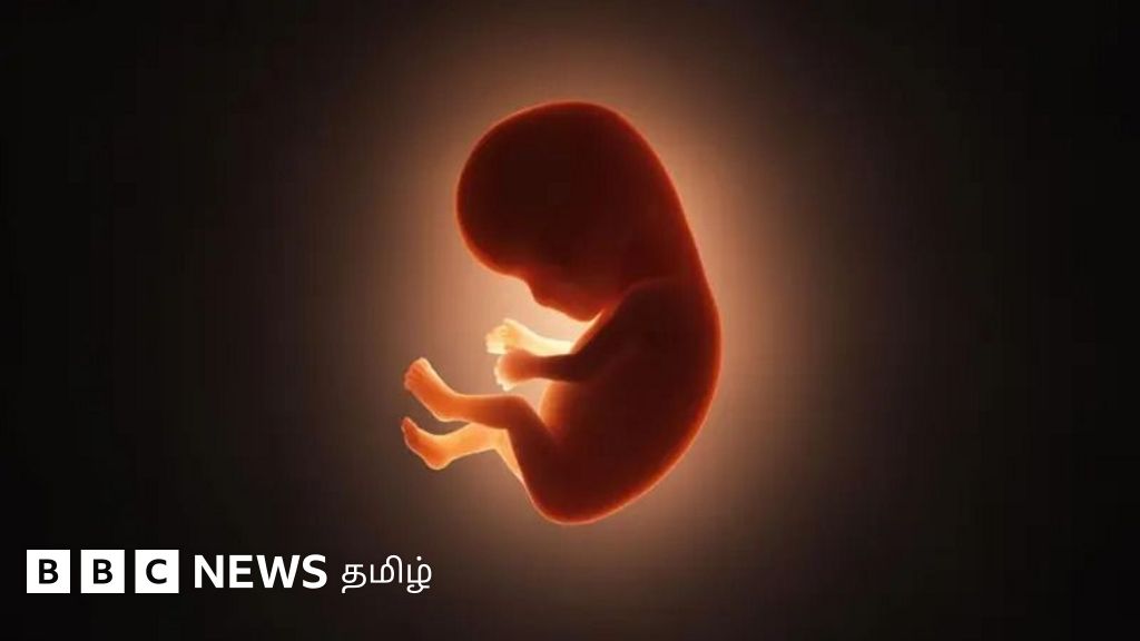 மூன்று மரபணுவில் பிறக்கும் குழந்தைகள் - ஆபத்தான நோயை தவிர்க்கும் அற்புதம்