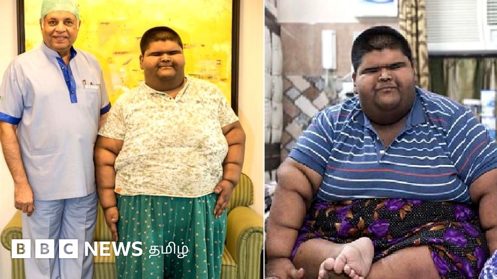 உடல் பருமன் குழந்தைகள் இந்தியாவில் அதிகமாகி வருவது ஏன்?