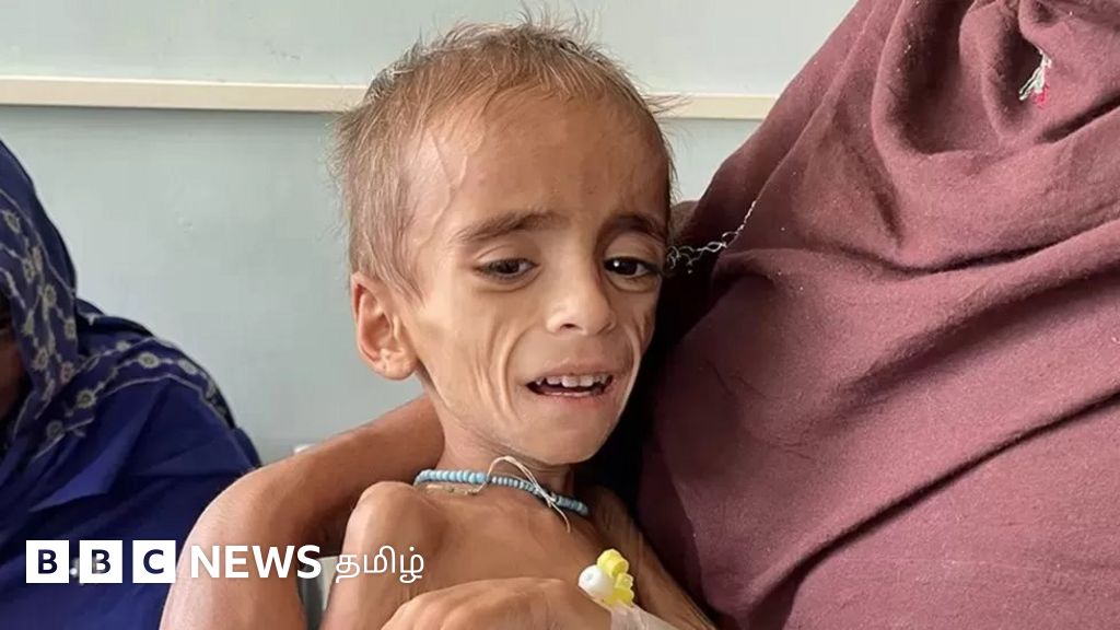 ஆப்கானிஸ்தானில் பட்டினிச் சூழல்: எப்படி கையாளப் போகிறது தாலிபன்?