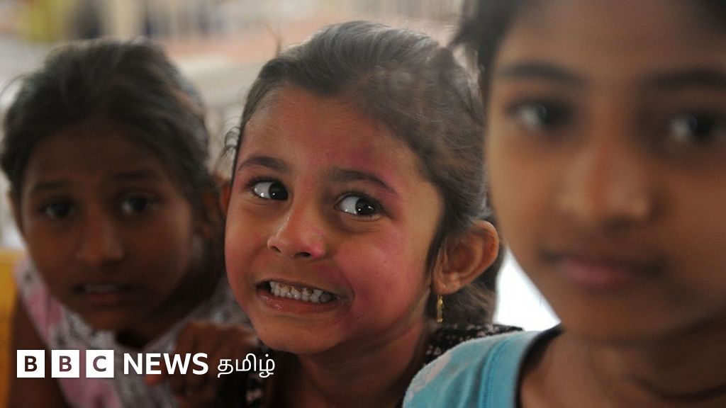 குழந்தைகளுக்கு அலர்ஜி ஏற்படுவது ஏன்? அதை எப்படி கையாள வேண்டும்?