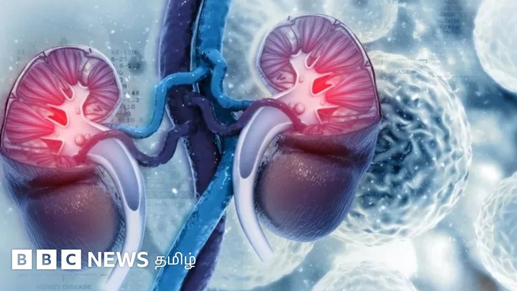 சிறுநீரக கல் என்பது என்ன? அது வராமல் தடுப்பது எப்படி?