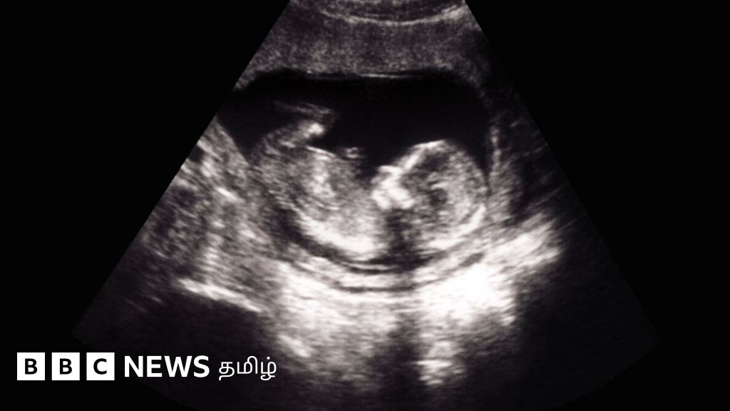 கட்டாய கருக்கலைப்பு: 2 வயது மகளுடன் சடலமாக மீட்கப்பட்ட பெண் - திருவண்ணாமலையில் என்ன நடந்தது?