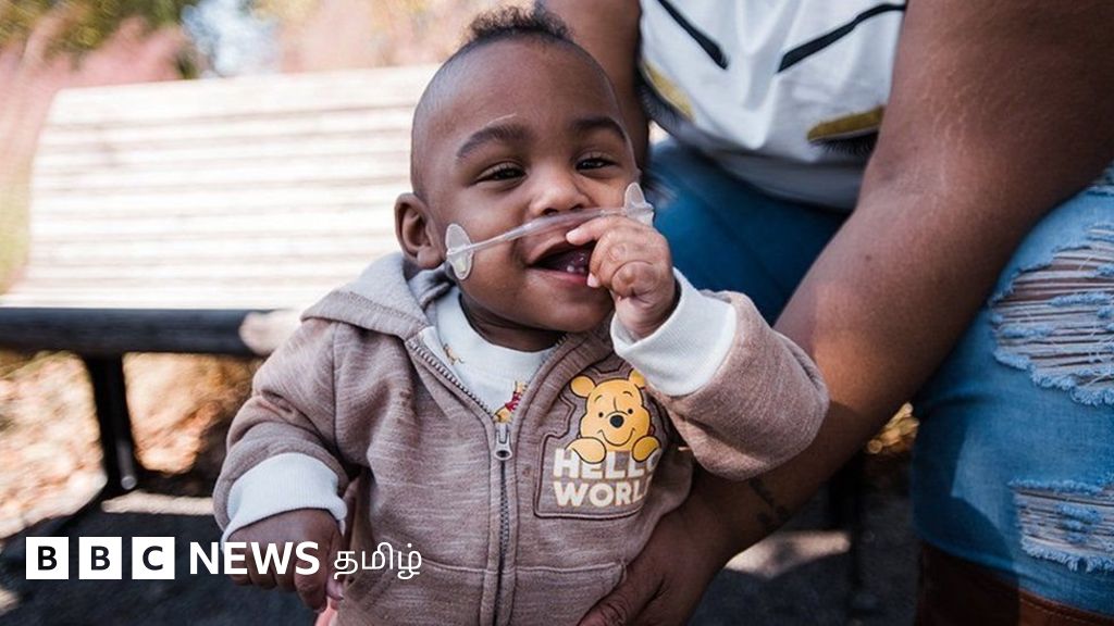 அமெரிக்காவில் அரை கிலோ எடையுடன் பிறந்த குழந்தை: கின்னஸ் புத்தகத்தில் இடம்பெற்று சாதனை