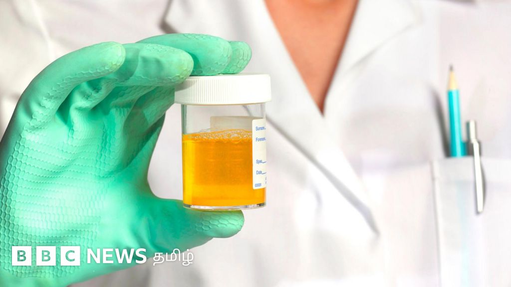 சிறுநீரின் நிறத்தை வைத்தே சிறுநீரகத்தில் உள்ள பிரச்னையை தெரிந்து கொள்வது எப்படி?