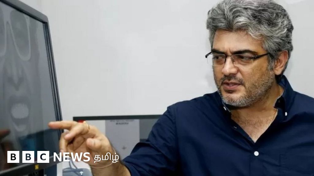டினிட்டஸ்: நடிகர் அஜித்குமார் காதுகளைப் பாதுகாக்க சொன்னது ஏன்? அவ்வளவு முக்கியமான பிரச்னையா?