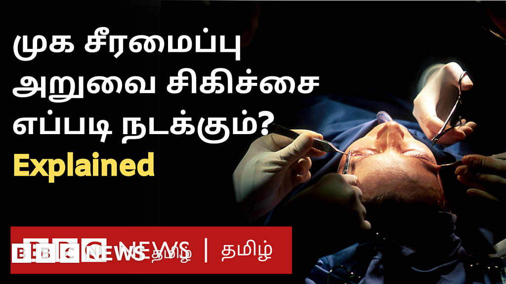 முக சீரமைப்பு அறுவை சிகிச்சை செய்யப்படுவது எப்படி? - மருத்துவர் விளக்கம்