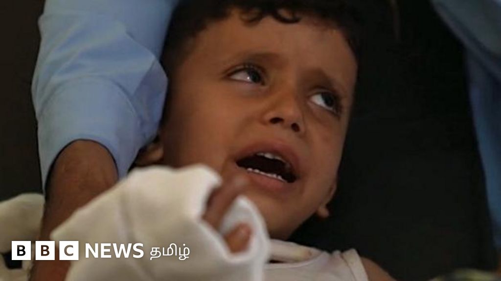 வீட்டில் கிடந்த வெடிகுண்டை எடுத்ததால் குழந்தைக்கு நேர்ந்த துயரம் – ஏமனில் தொடரும் அவலம் – காணொளி