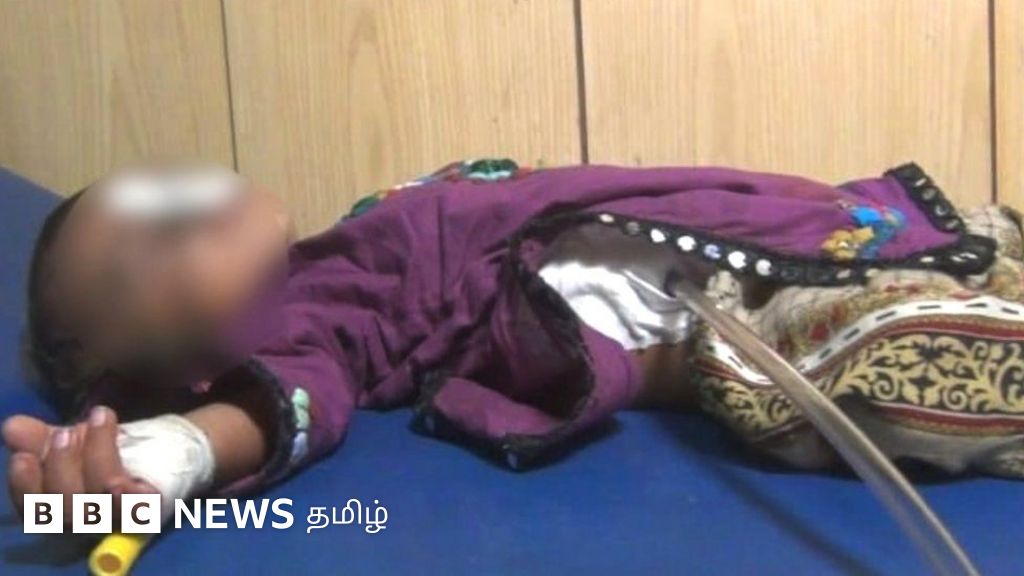 10 மாத பெண் குழந்தை கர்ப்பமா? வயிற்றுக்குள் கரு உருவானது எப்படி?