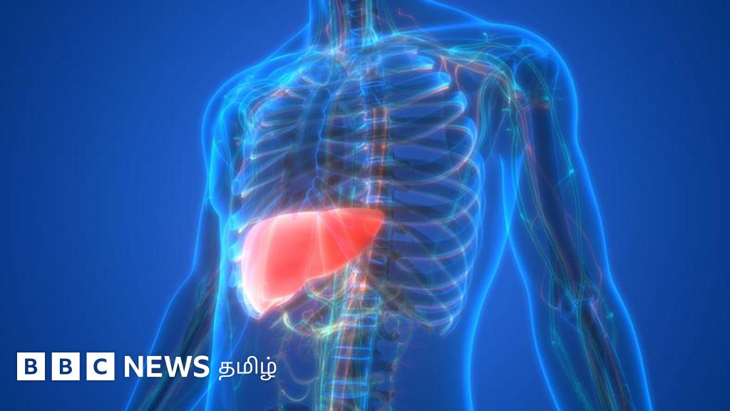 குடிப்பழக்கம் உள்ளவர்களுக்கு ஏற்பட்ட கல்லீரல் பாதிப்பு குடிக்காதவர்களுக்கும் ஏற்படுவது ஏன்?