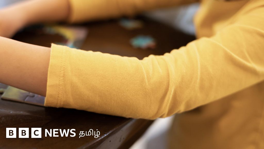 அரசு மருத்துவமனையில் தவறான சிகிச்சையால் மகளுக்கு காலில் குறைபாடு ஏற்பட்டதாக போலீஸ்காரர் குற்றச்சாட்டு - என்ன நடந்தது?