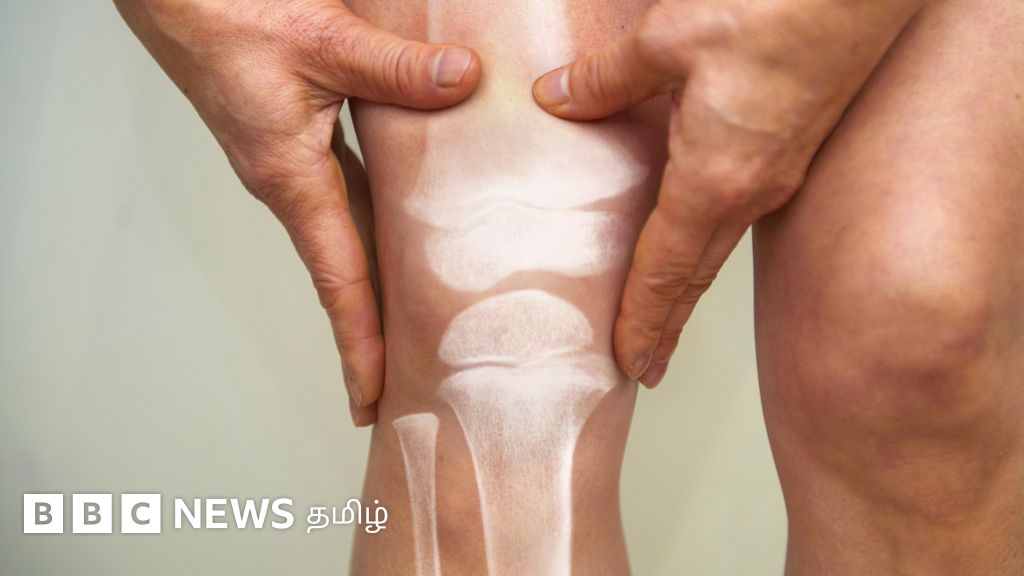 ஆர்த்தரைட்டிஸ் என்பது என்ன? தற்காப்பது எப்படி?