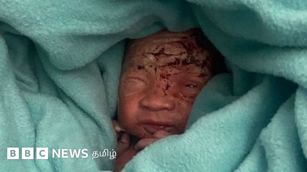 மொரிஷியஸ் விமானத்தின் கழிவறை குப்பைத்தொட்டியில் பச்சிளம் குழந்தை