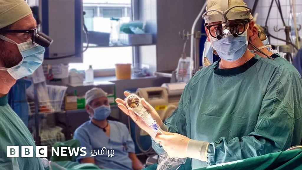 பைபாஸ் அறுவை சிகிச்சைக்குப் பின் இதயத்தின் திறனை அதிகரிக்கும் கருவி - புதிய ஆய்வில் தகவல் 